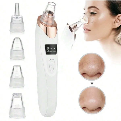 Limpiador facial de poros - Extractor de puntos negros con 5 niveles de succión.