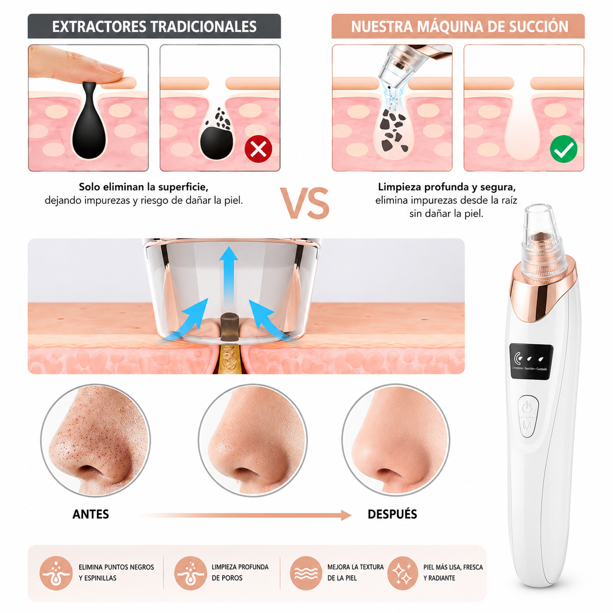 Limpiador facial de poros - Extractor de puntos negros con 5 niveles de succión.