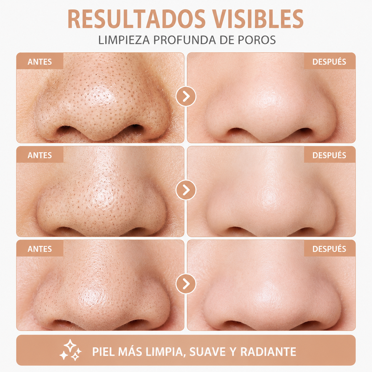 Limpiador facial de poros - Extractor de puntos negros con 5 niveles de succión.